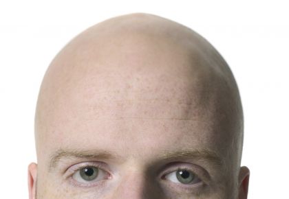 看图识字，那个英语词汇是对的？ Fat,Dimples,Regular features,Bald